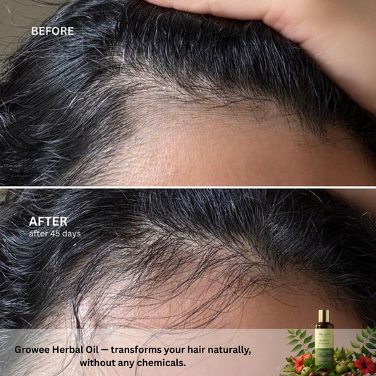 Growee Herbal Hair Care Combo – Buy Oil, Get Shampoo Free